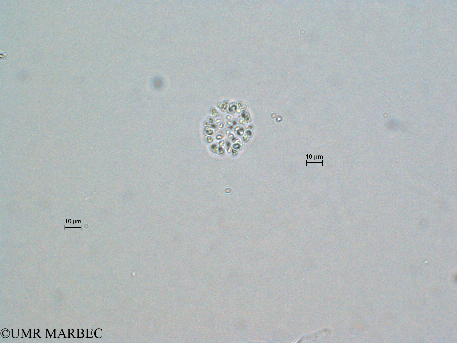 phyto/Scattered_Islands/europa/COMMA April 2011/Botryococcus sp (1)(copy).jpg